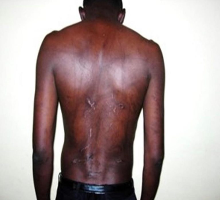 Torture des Journalistes: L’histoire Douloureuse du Gambien Musa Saidykhan