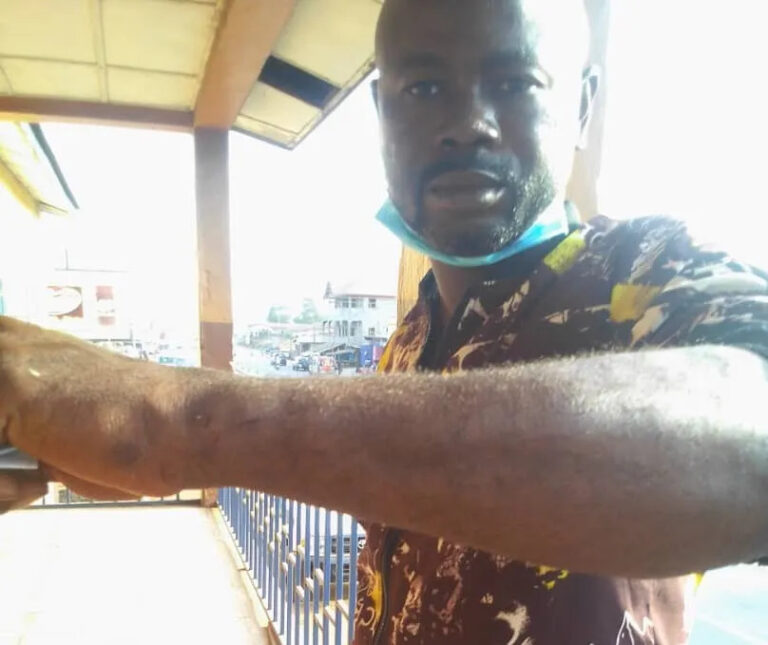 Sierra Leone : Un journaliste brutalisé alors qu’il couvrait un conflit foncier