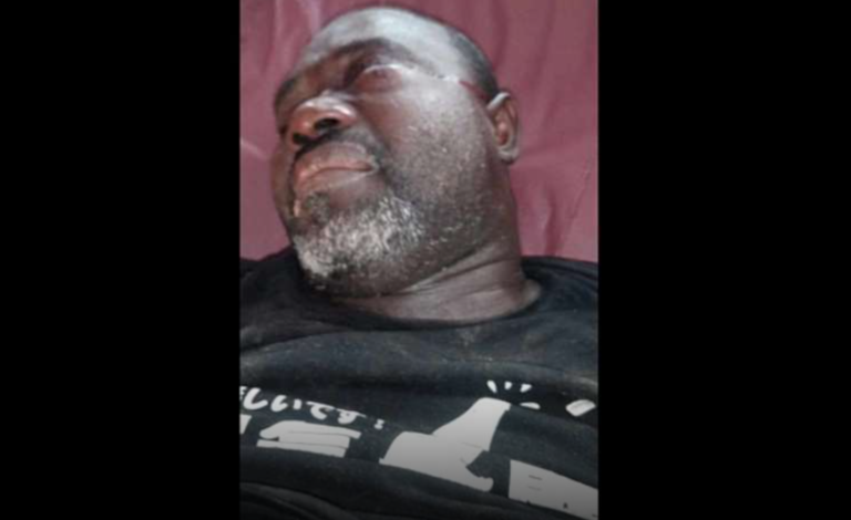 Liberia: Security officers brutally assault a journalist with Radio Fuamah